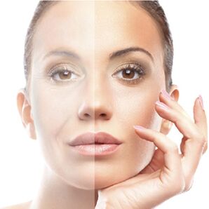 Floor skin rejuvenation